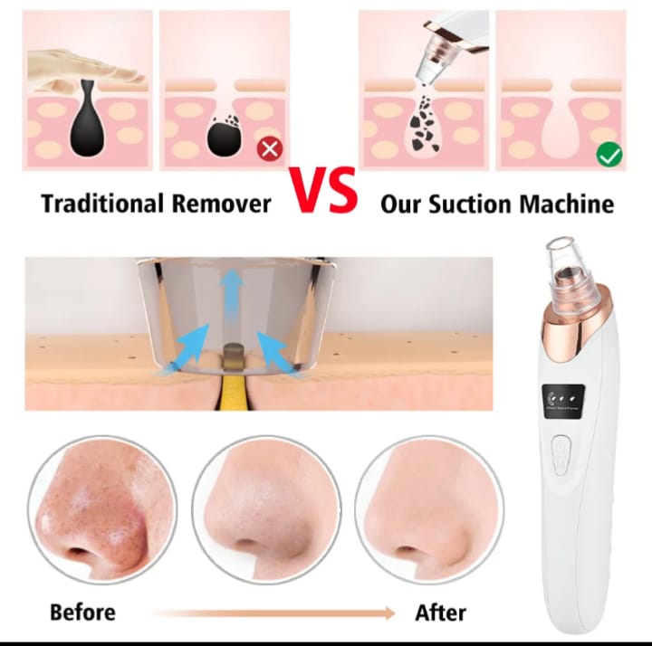 Electric Blackhead Remover Vacuum Pore Cleaner